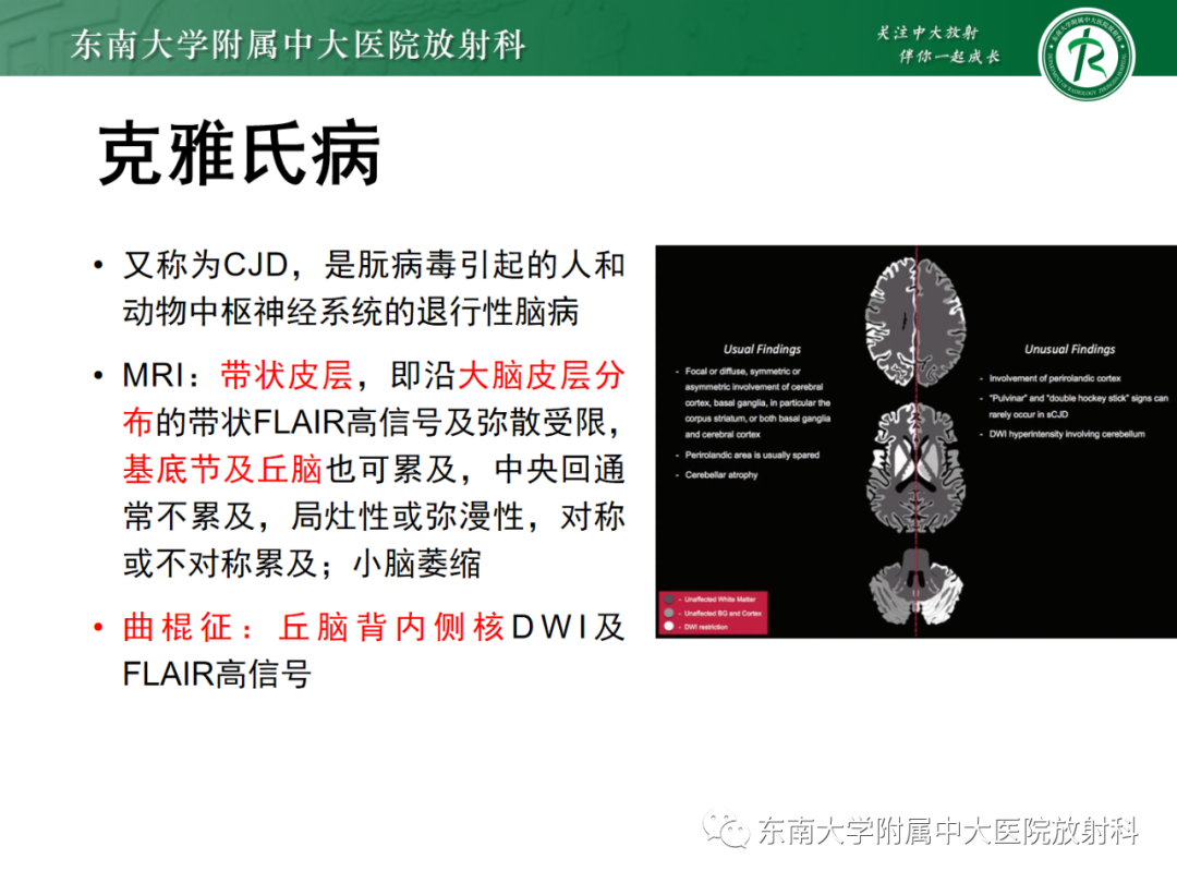 影像PPT - 【PPT】成人缺血缺氧性脑病(HIE)-24 影像PPT - 【PPT】成人缺血缺氧性脑病(HIE)-24