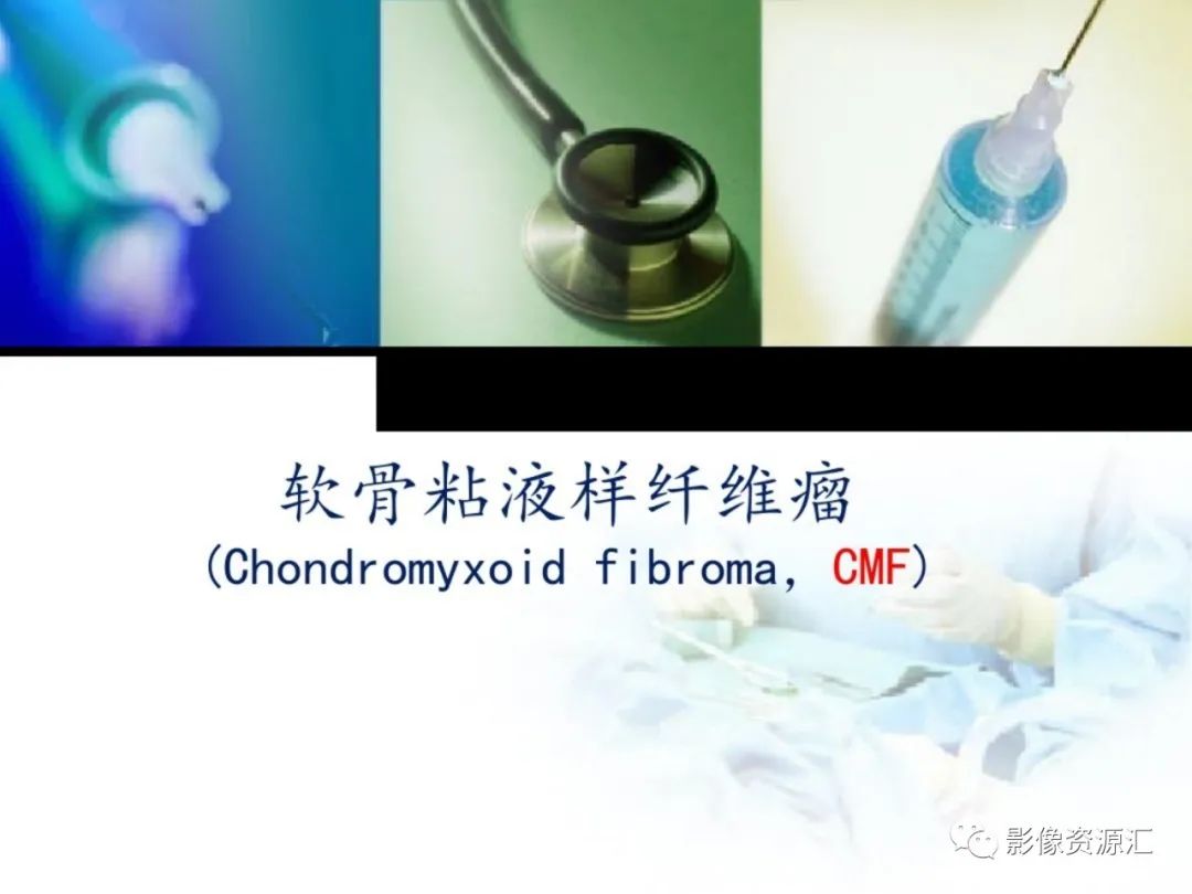 影像PPT - 【PPT】软骨粘液纤维性瘤-1