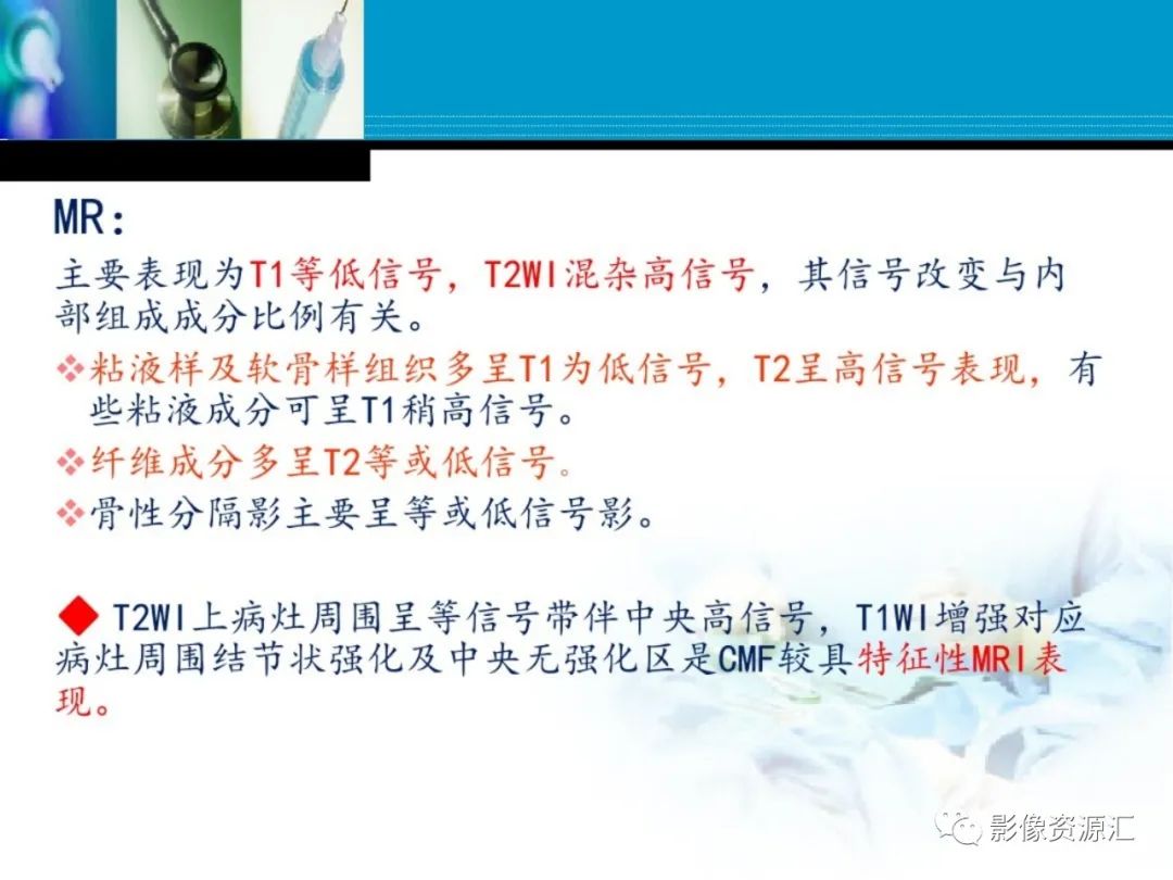 影像PPT - 【PPT】软骨粘液纤维性瘤-10
