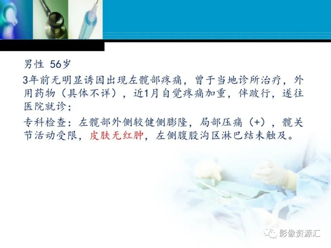 影像PPT - 【PPT】软骨粘液纤维性瘤-13