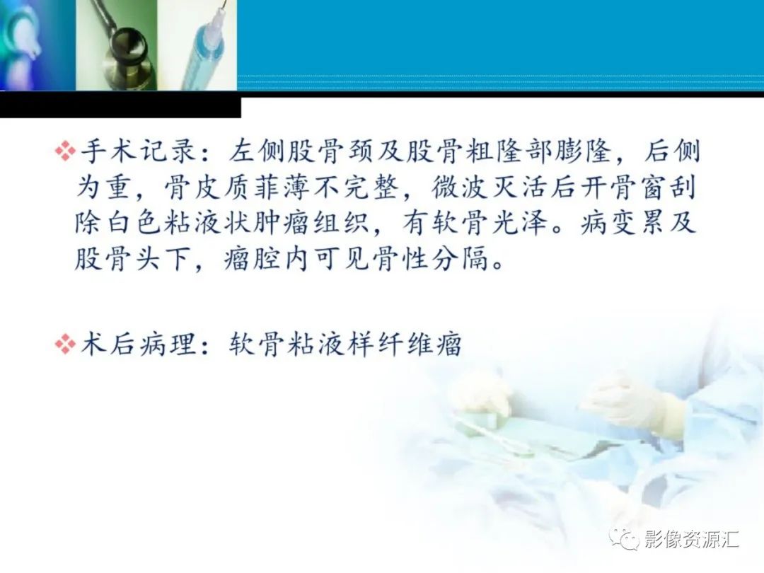 影像PPT - 【PPT】软骨粘液纤维性瘤-19