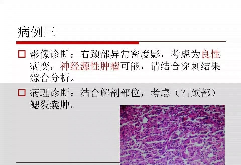 影像PPT - 颈部肿块影像诊断与鉴别诊断—鳃裂囊肿-8