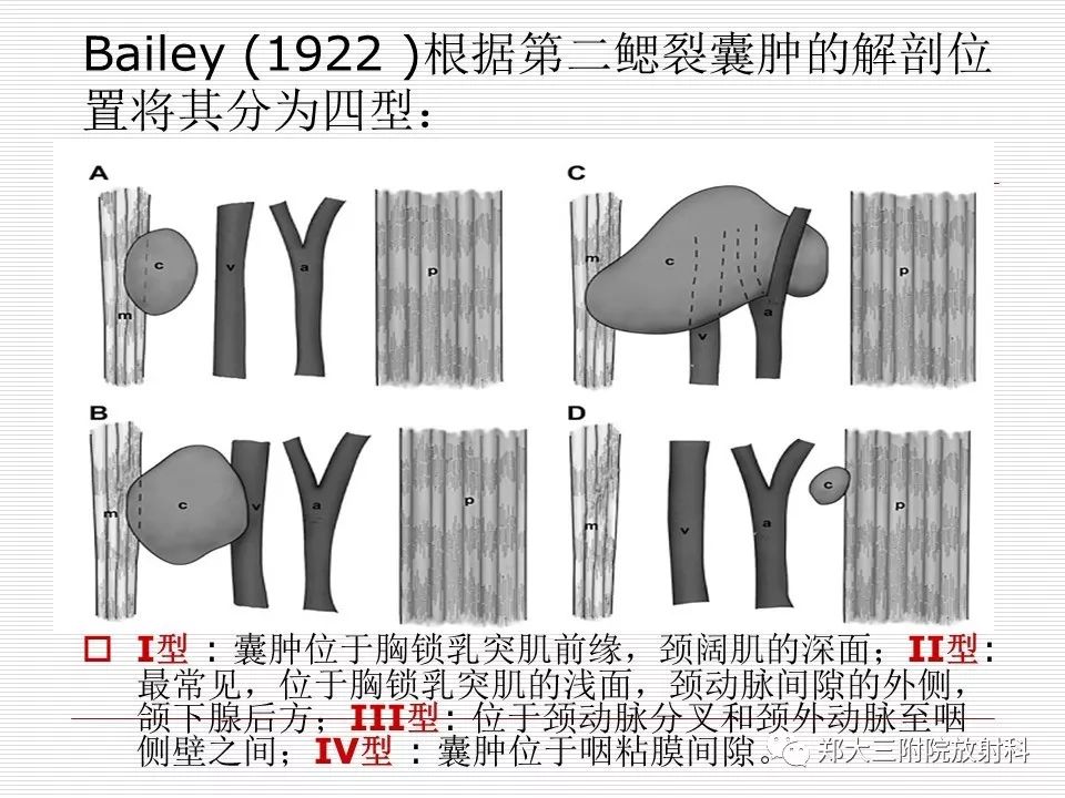 影像PPT - 颈部肿块影像诊断与鉴别诊断—鳃裂囊肿-19
