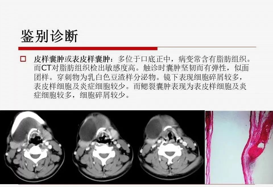 影像PPT - 颈部肿块影像诊断与鉴别诊断—鳃裂囊肿-24