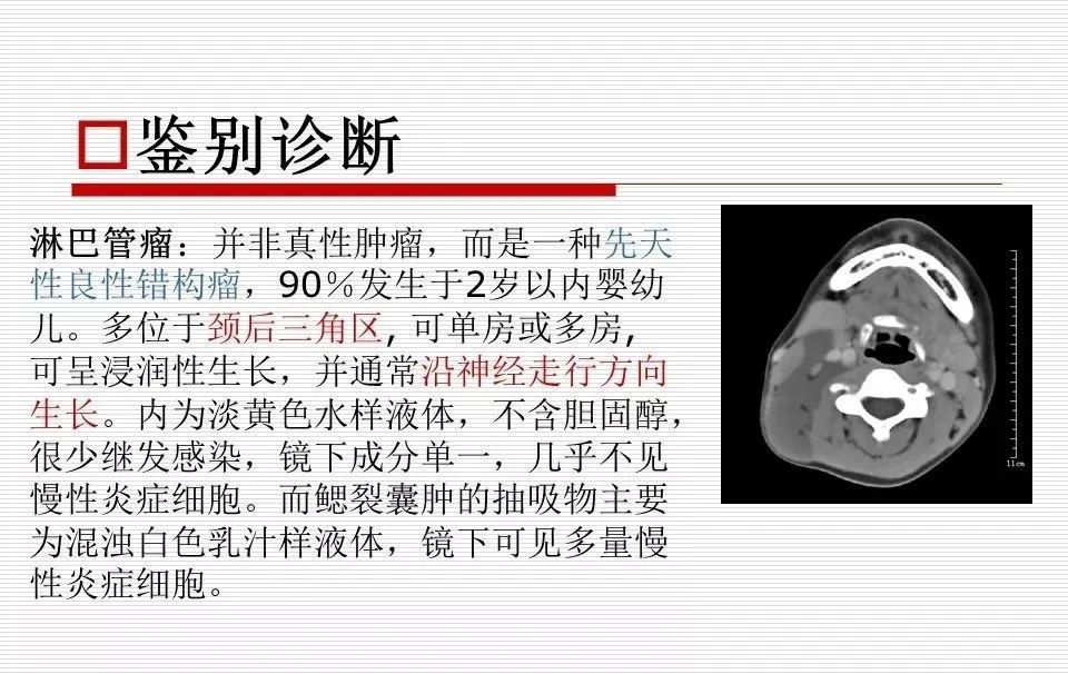 影像PPT - 颈部肿块影像诊断与鉴别诊断—鳃裂囊肿-27