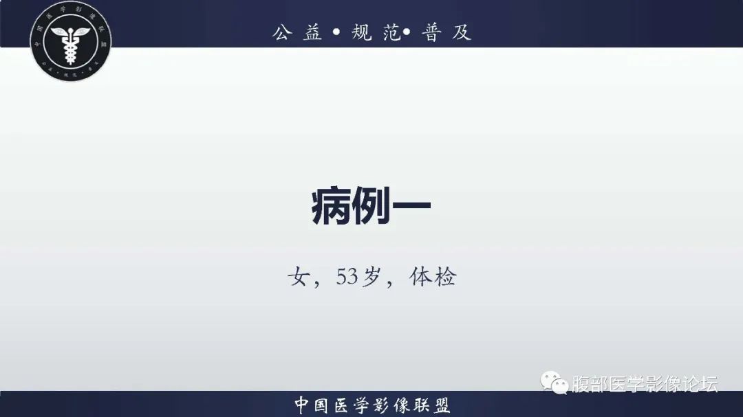 影像PPT - 【病例】肝脏遗传性出血性毛细血管扩张症2例-2 影像PPT - 【病例】肝脏遗传性出血性毛细血管扩张症2例-2