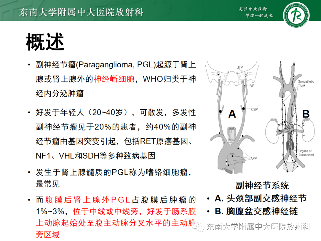 影像PPT - 【PPT】腹膜后副神经节瘤的影像-5