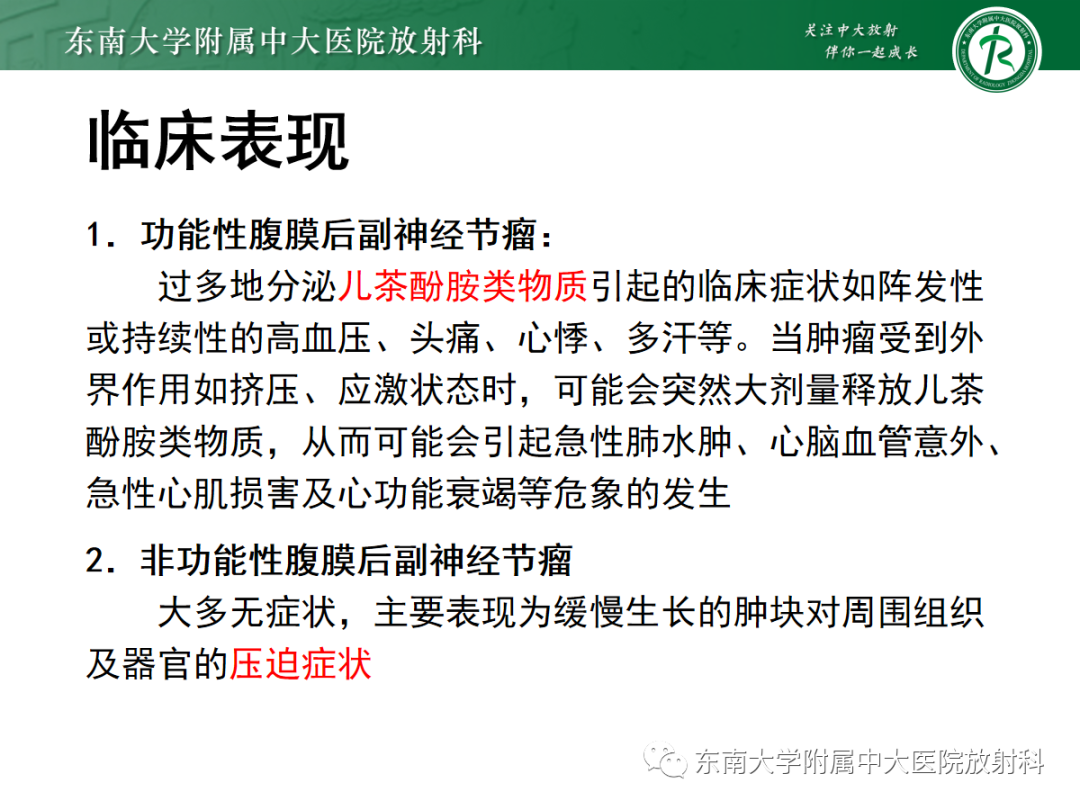 影像PPT - 【PPT】腹膜后副神经节瘤的影像-9