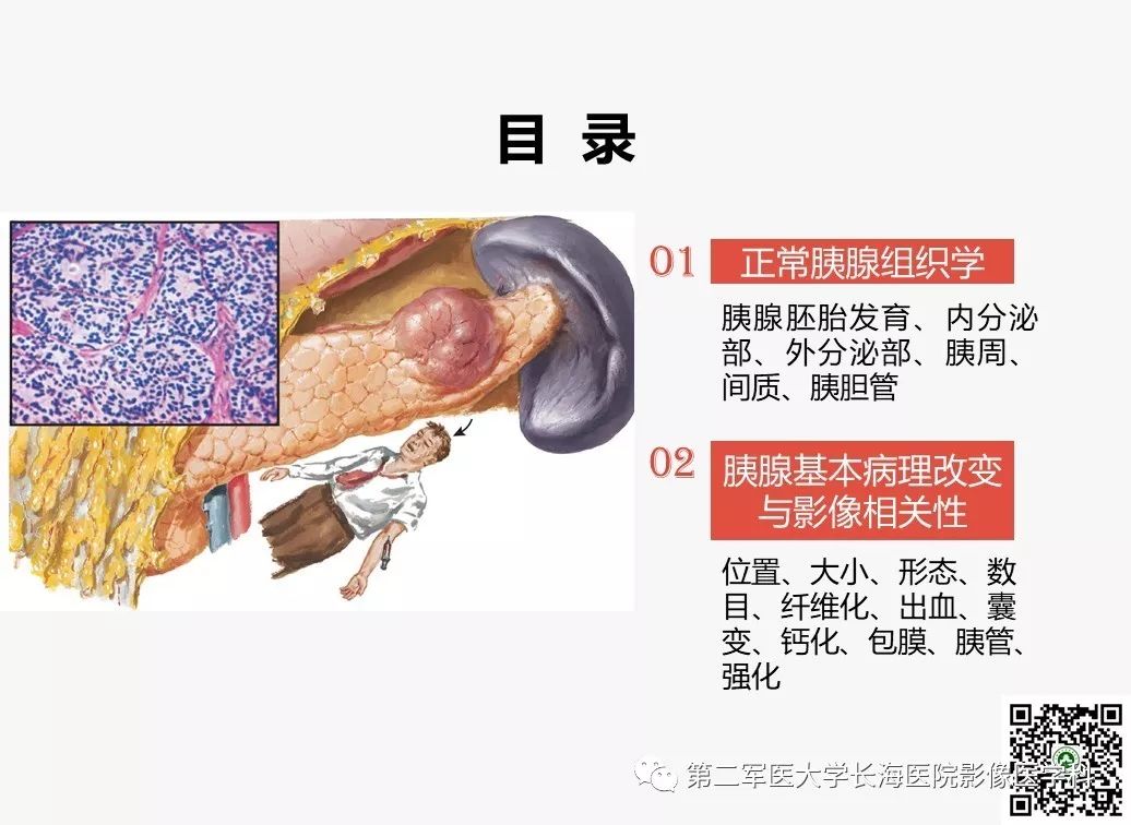 影像PPT - 【PPT】胰腺基本病变：影像与病理-2