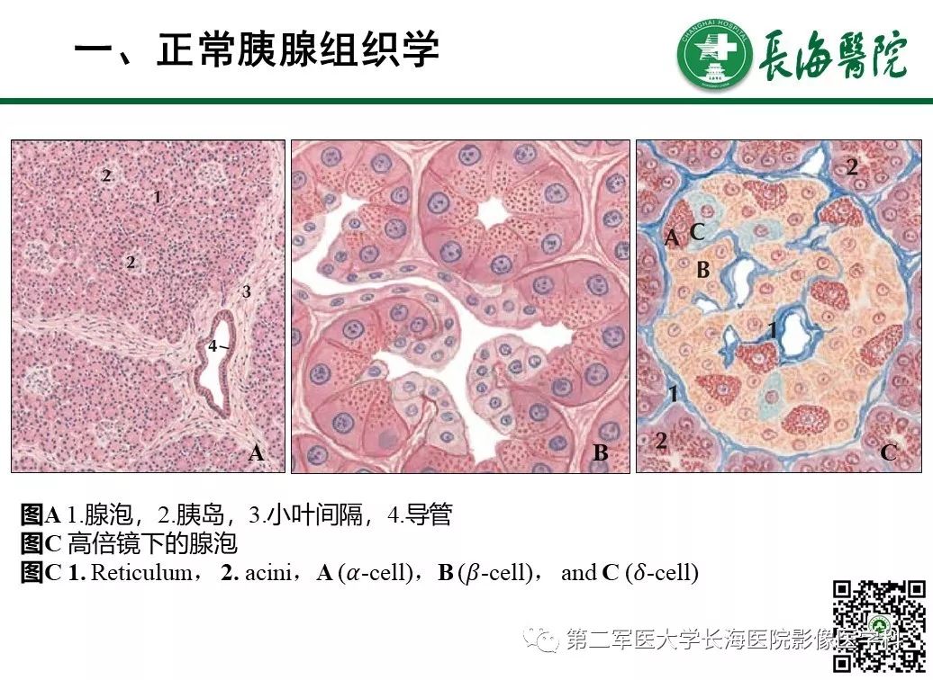影像PPT - 【PPT】胰腺基本病变：影像与病理-4
