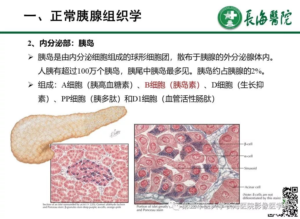 影像PPT - 【PPT】胰腺基本病变：影像与病理-5
