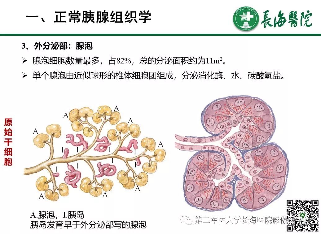 影像PPT - 【PPT】胰腺基本病变：影像与病理-6