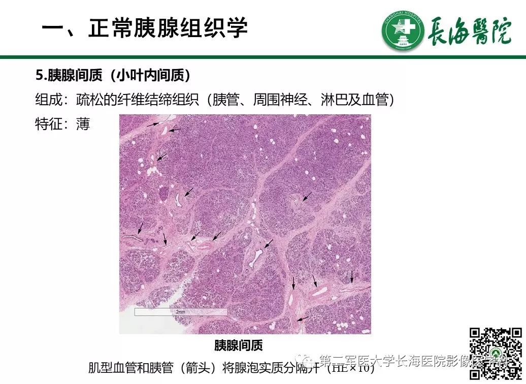 影像PPT - 【PPT】胰腺基本病变：影像与病理-8