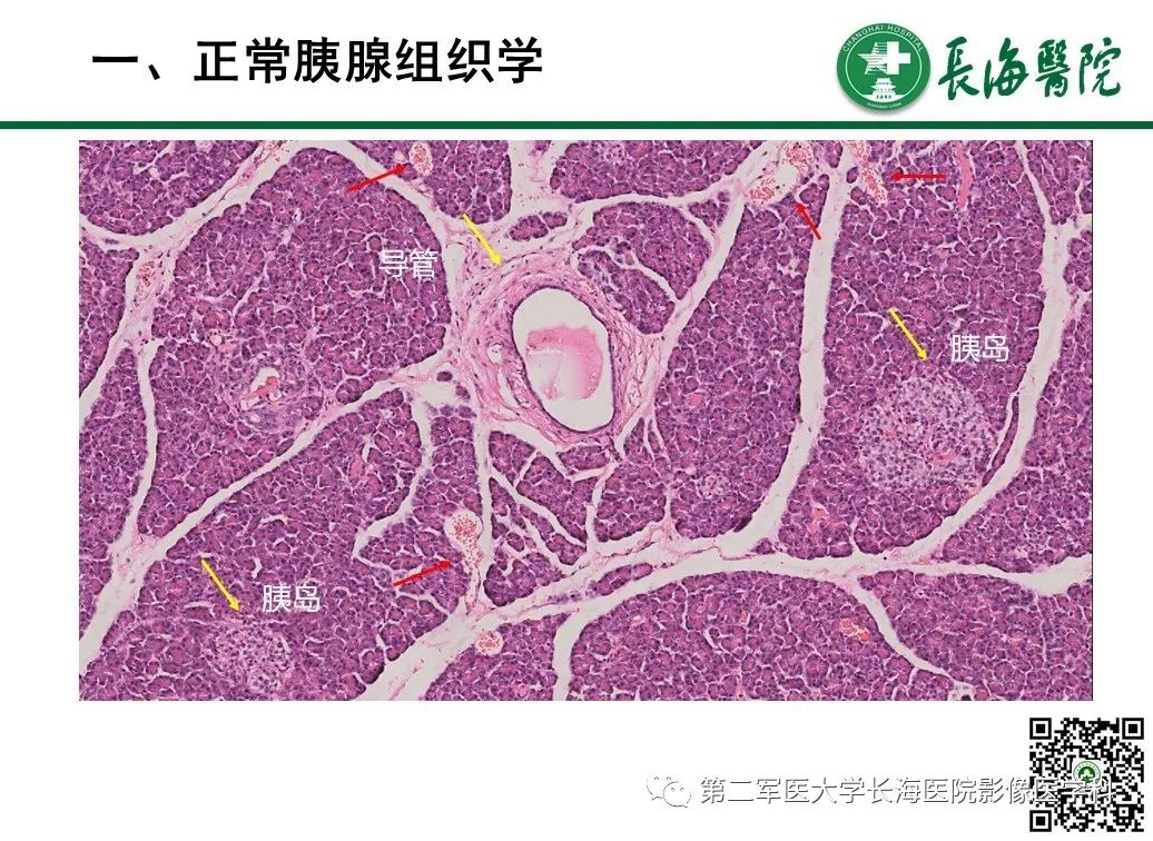 影像PPT - 【PPT】胰腺基本病变：影像与病理-9