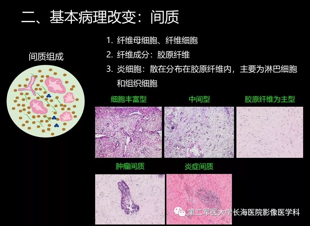 影像PPT - 【PPT】胰腺基本病变：影像与病理-27
