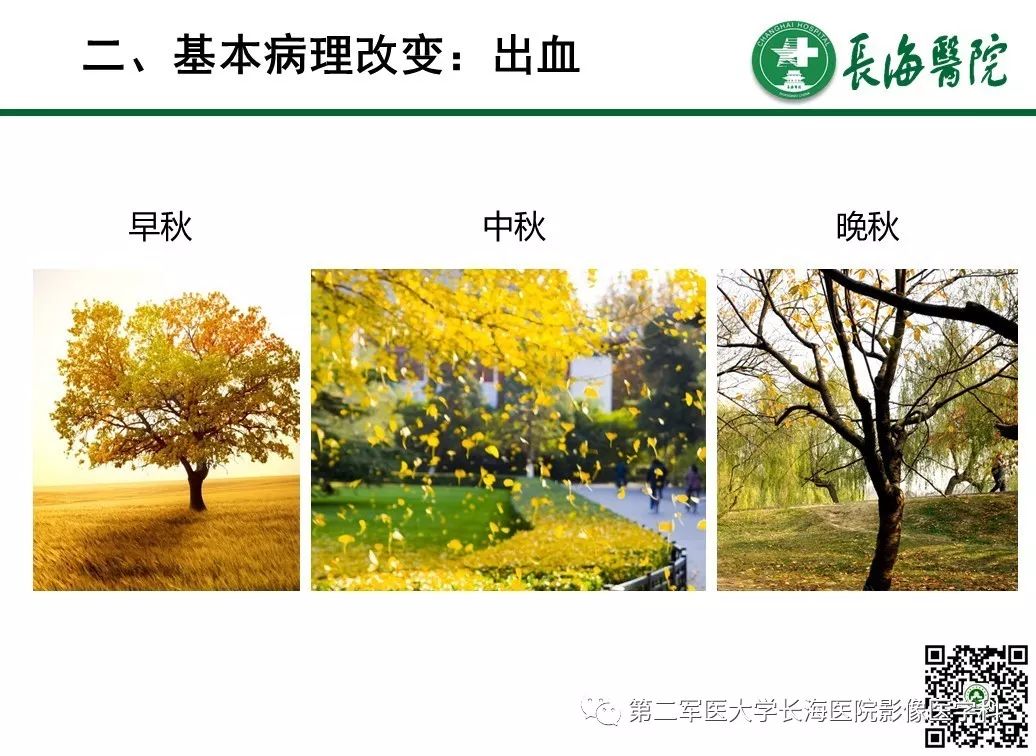 影像PPT - 【PPT】胰腺基本病变：影像与病理-36