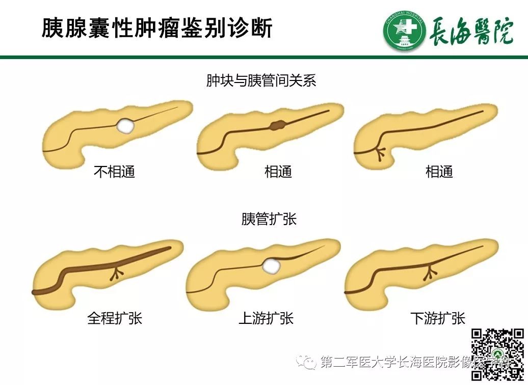 影像PPT - 【PPT】胰腺基本病变：影像与病理-62