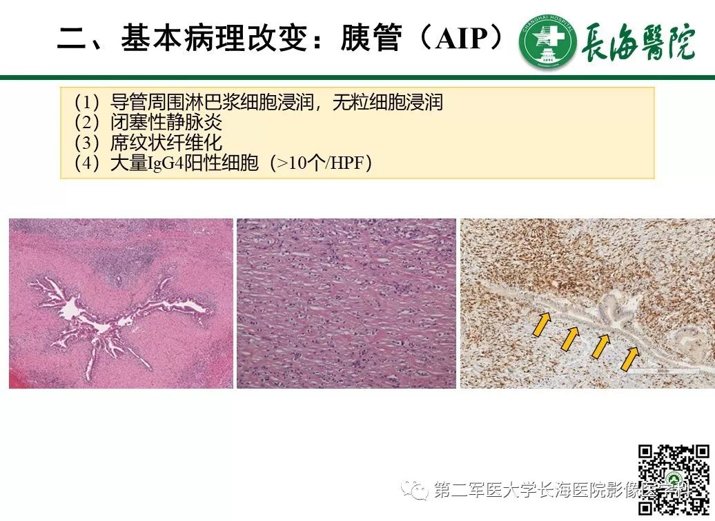 影像PPT - 【PPT】胰腺基本病变：影像与病理-64