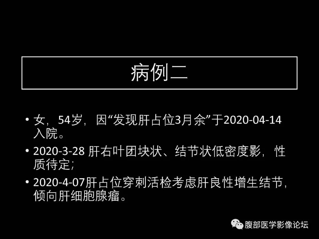 影像PPT - 【病例】肝脏透明细胞癌1例CT及MR-1