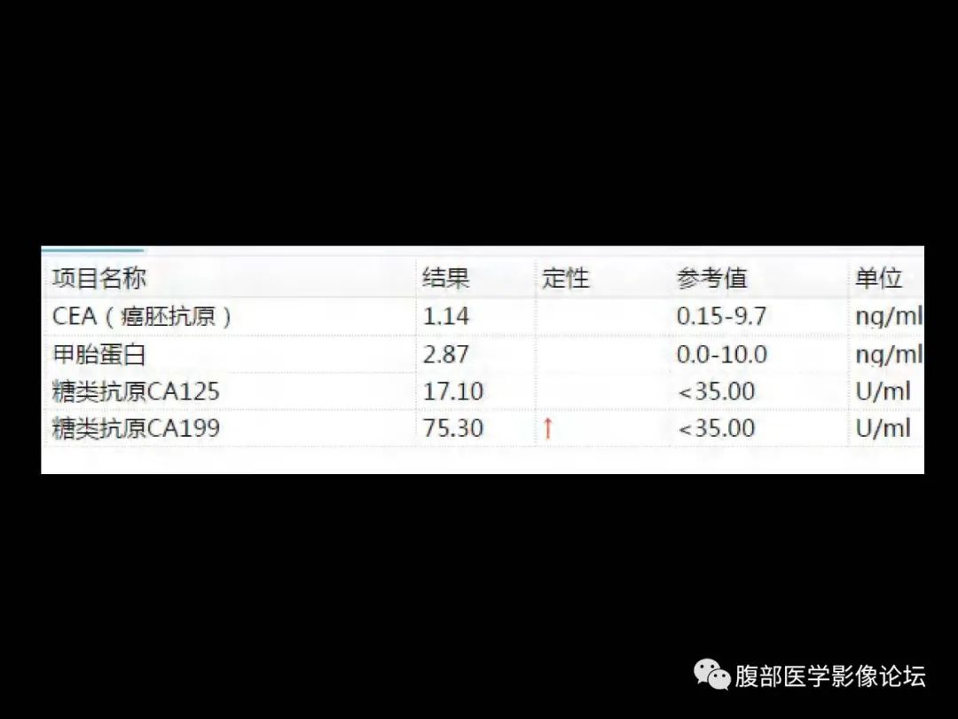 影像PPT - 【病例】肝脏透明细胞癌1例CT及MR-2