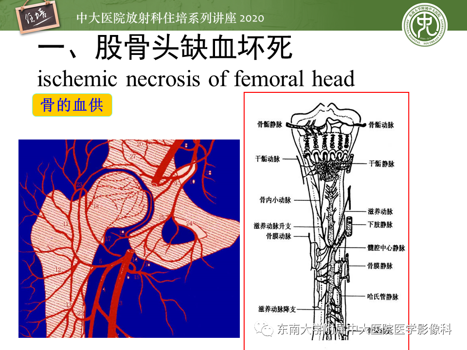 影像PPT - 【PPT】骨缺血坏死性病变的影像学特征-5