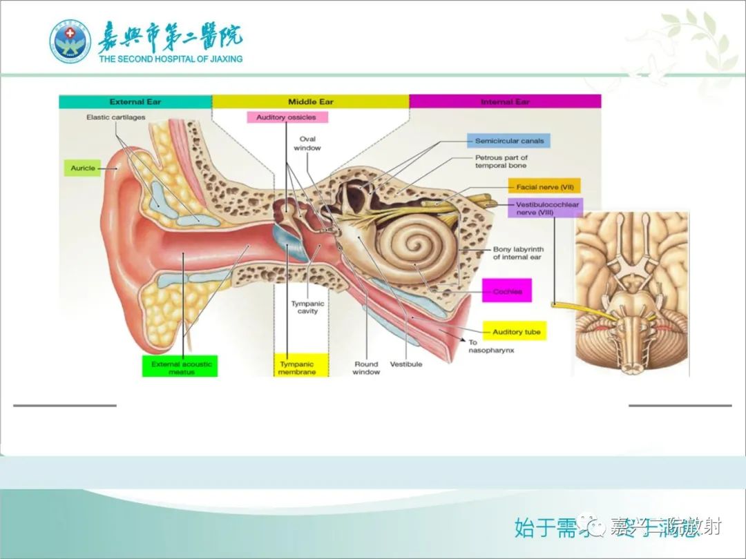 影像PPT - 【PPT】内耳MR成像解剖及观察-2