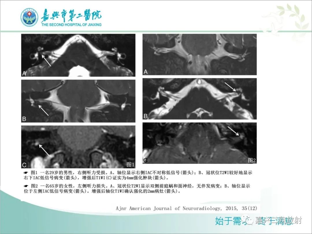 影像PPT - 【PPT】内耳MR成像解剖及观察-9