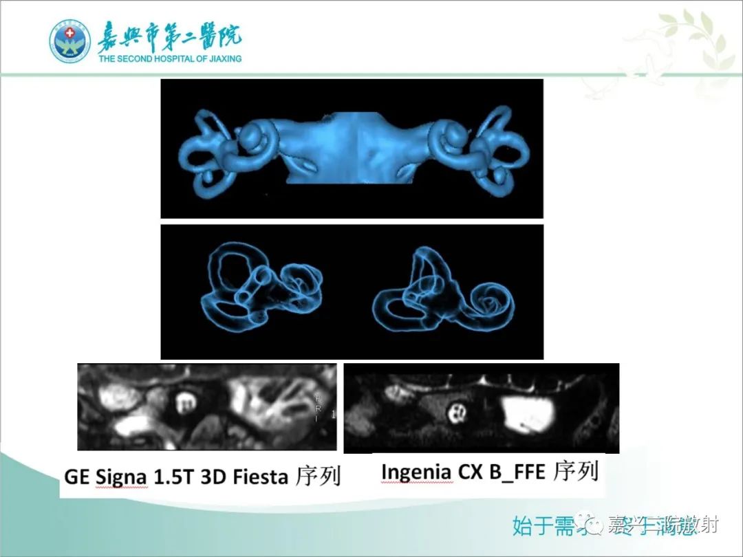 影像PPT - 【PPT】内耳MR成像解剖及观察-20