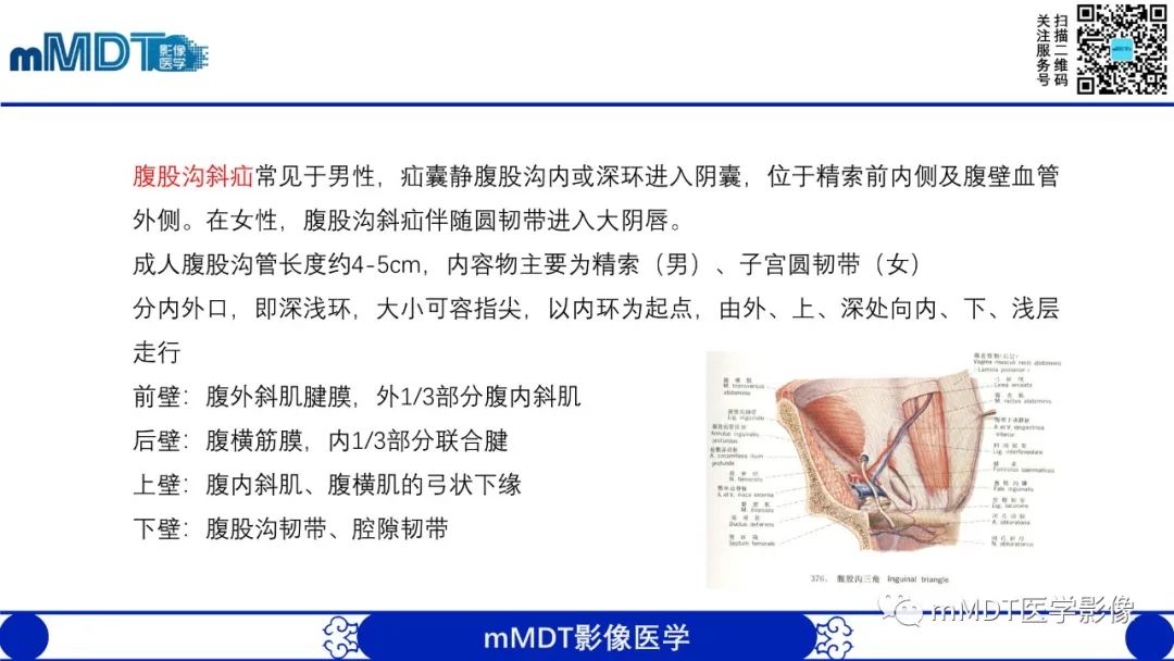 影像PPT - 【PPT】常见腹外疝的影像诊断-3 影像PPT - 【PPT】常见腹外疝的影像诊断-3
