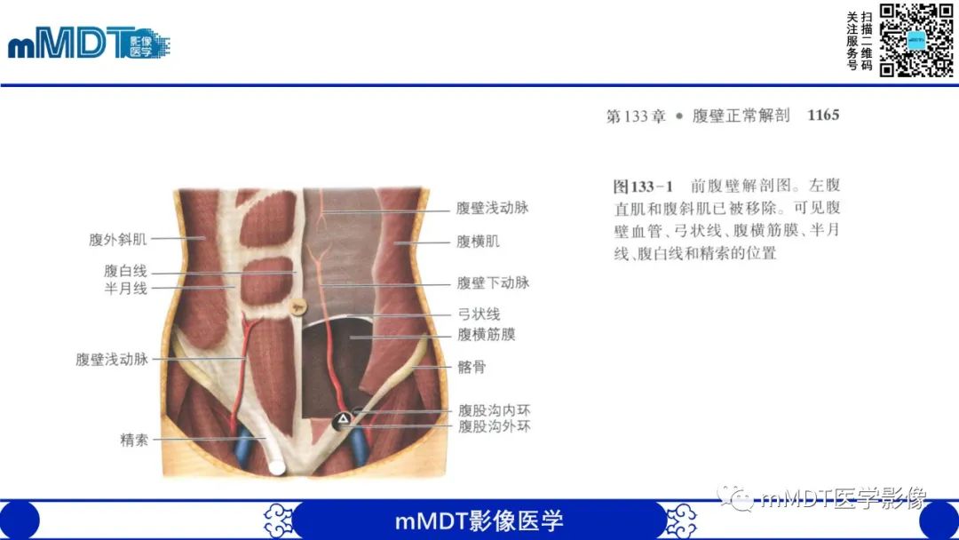 影像PPT - 【PPT】常见腹外疝的影像诊断-4 影像PPT - 【PPT】常见腹外疝的影像诊断-4