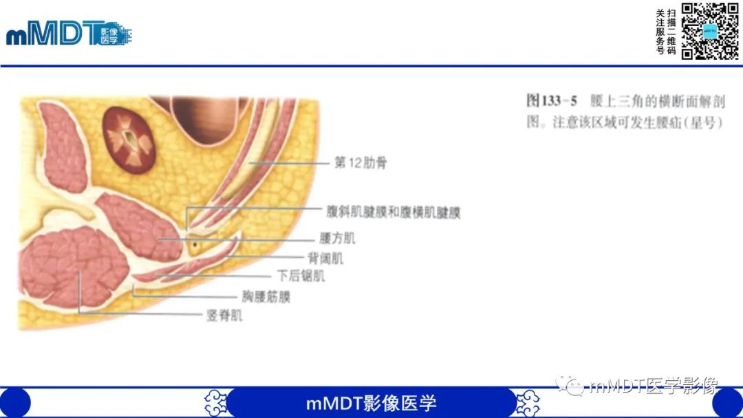 影像PPT - 【PPT】常见腹外疝的影像诊断-24 影像PPT - 【PPT】常见腹外疝的影像诊断-24