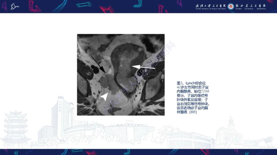 影像PPT - 【PPT】遗传性胃肠肿瘤综合征：影像学在筛查、诊断和治疗中的作用-9