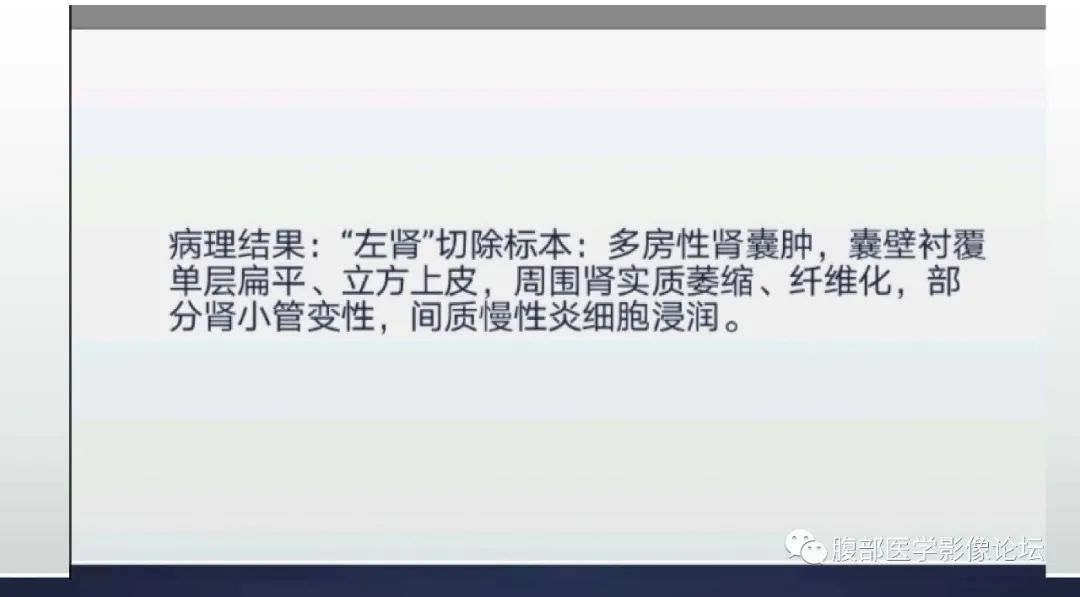 影像PPT - 【病例】多房性肾囊肿1例CT-16