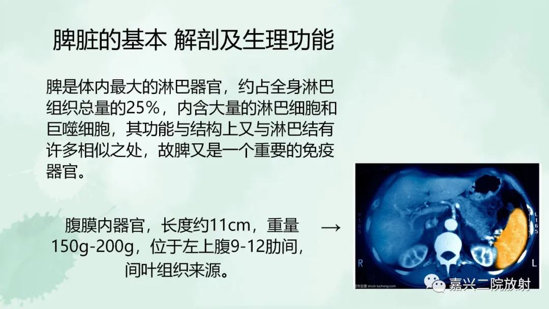 影像PPT - 【PPT】脾脏常见非肿瘤性病变-2