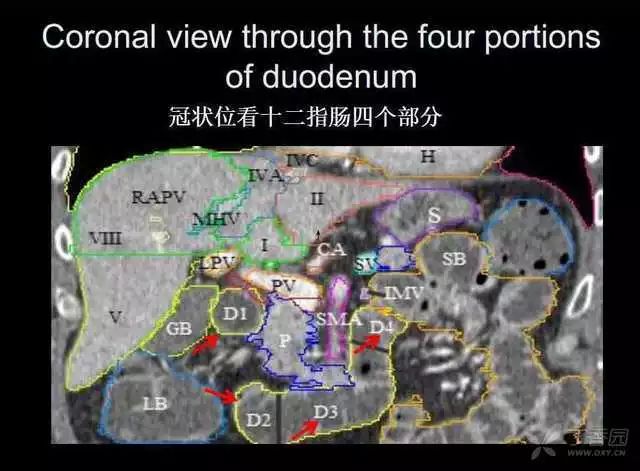 影像PPT - 【PPT】上腹部正常影像解剖-51 影像PPT - 【PPT】上腹部正常影像解剖-51