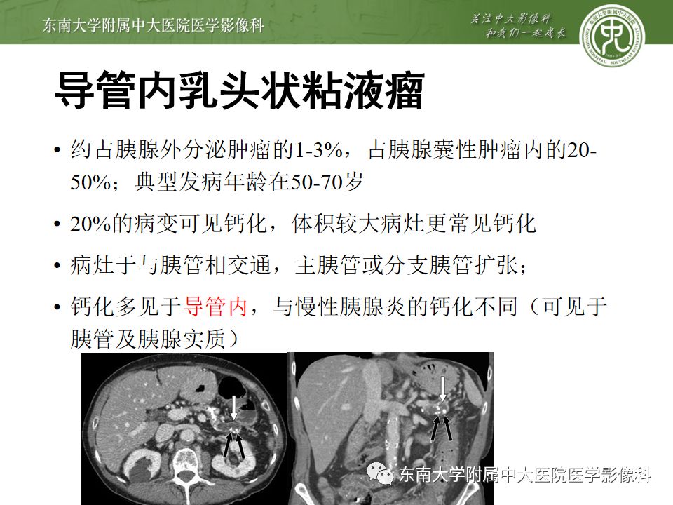 影像PPT - 【PPT】胰腺含钙化肿物的CT鉴别诊断-21