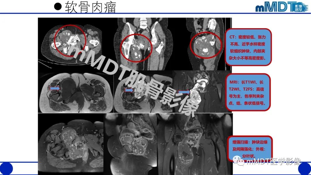 影像PPT - 【PPT】浅析软组织高密度影-35 影像PPT - 【PPT】浅析软组织高密度影-35