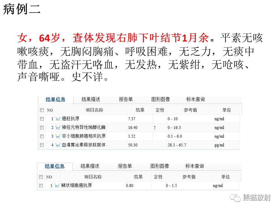 影像PPT - 【病例】肺浸润性腺癌2例CT影像-12