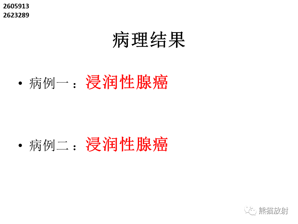 影像PPT - 【病例】肺浸润性腺癌2例CT影像-21