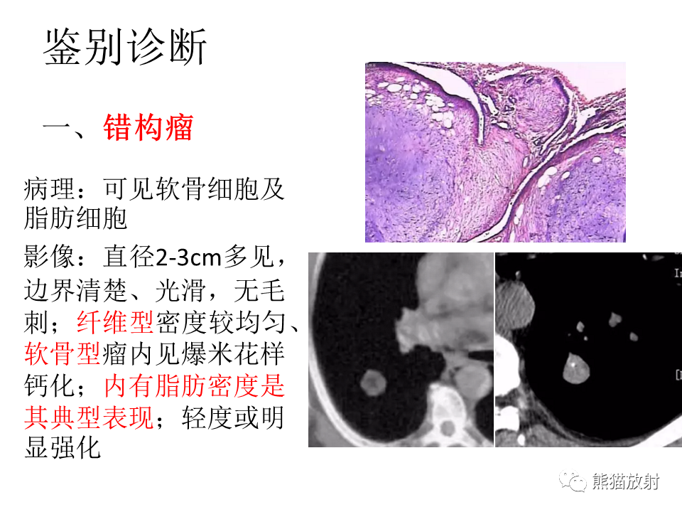 影像PPT - 【病例】肺浸润性腺癌2例CT影像-36