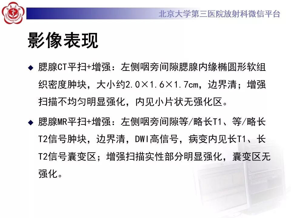 影像PPT - 【PPT】咽旁间隙基底细胞腺瘤的影像-10