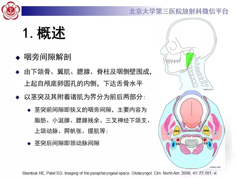 影像PPT - 【PPT】咽旁间隙基底细胞腺瘤的影像-13