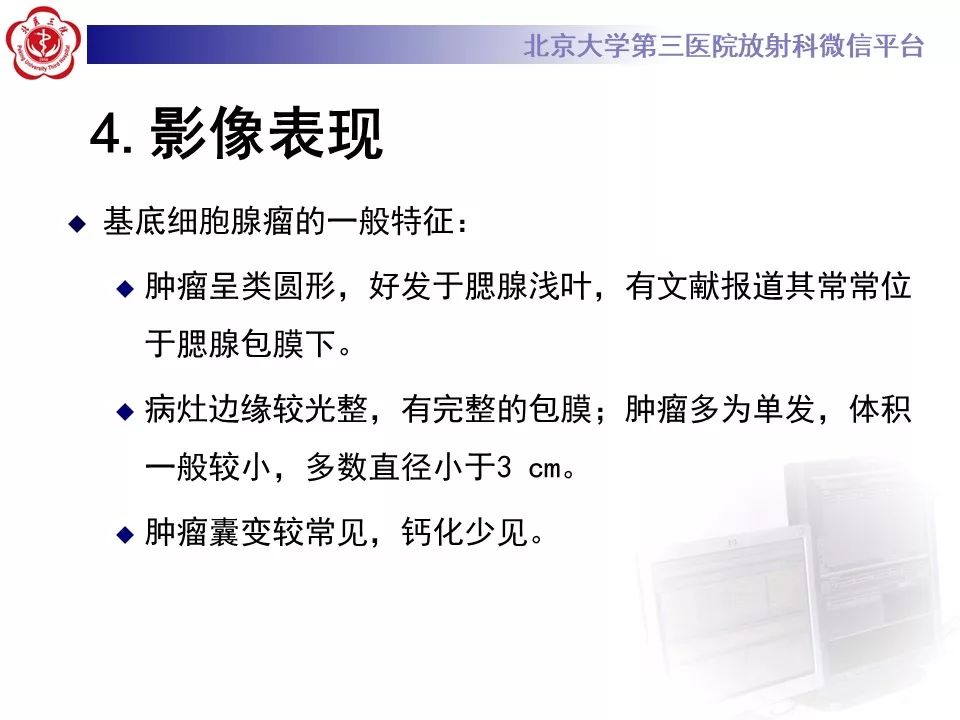 影像PPT - 【PPT】咽旁间隙基底细胞腺瘤的影像-20