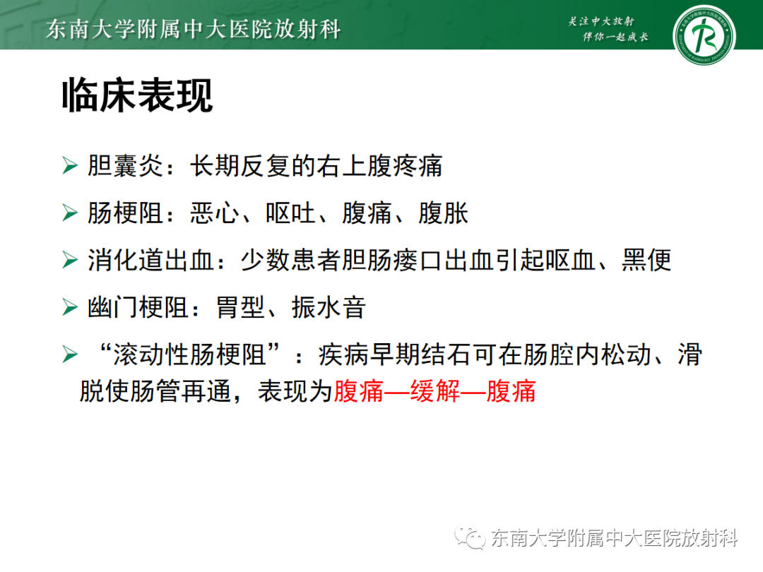 影像PPT - 【PPT】胆石性肠梗阻-8