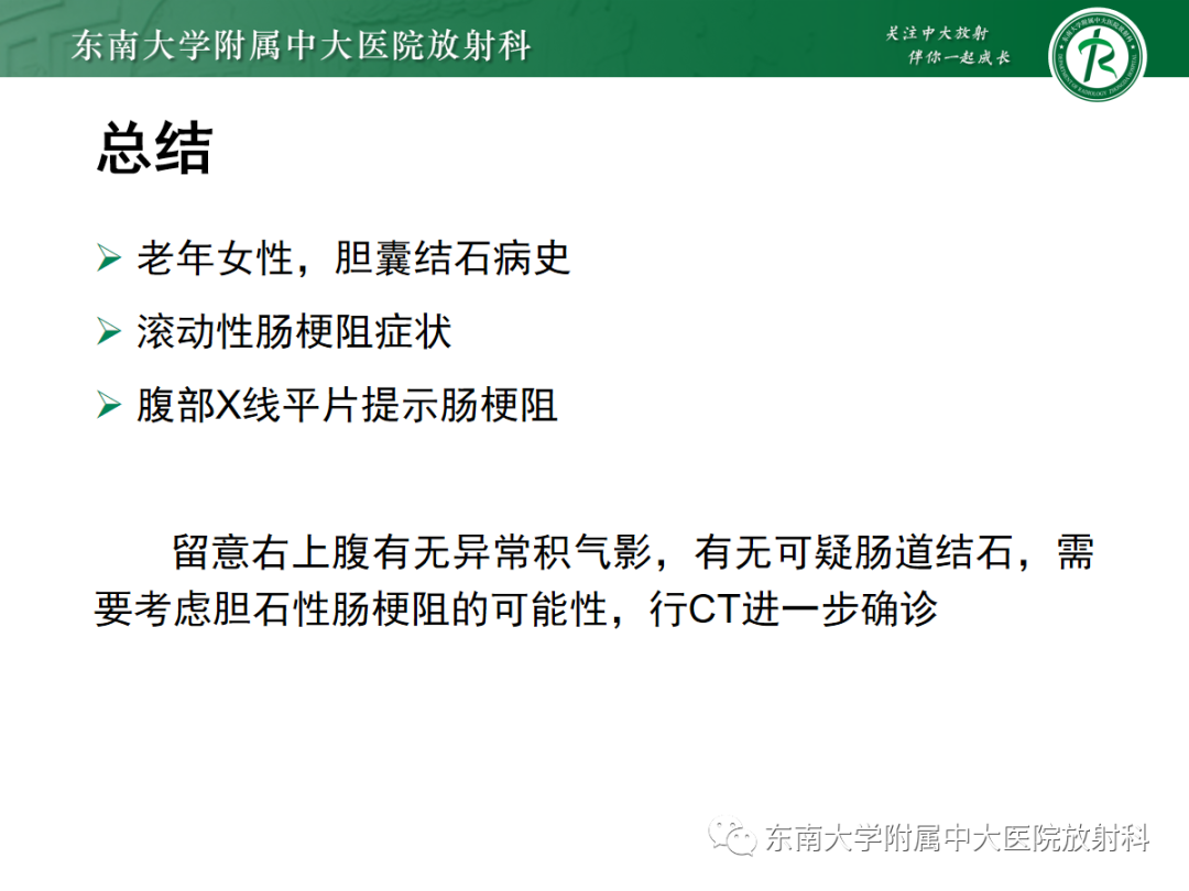 影像PPT - 【PPT】胆石性肠梗阻-26