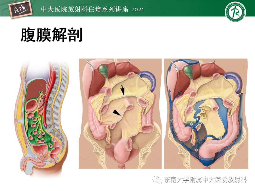 影像PPT - 【PPT】腹膜病变的影像分析思路-2