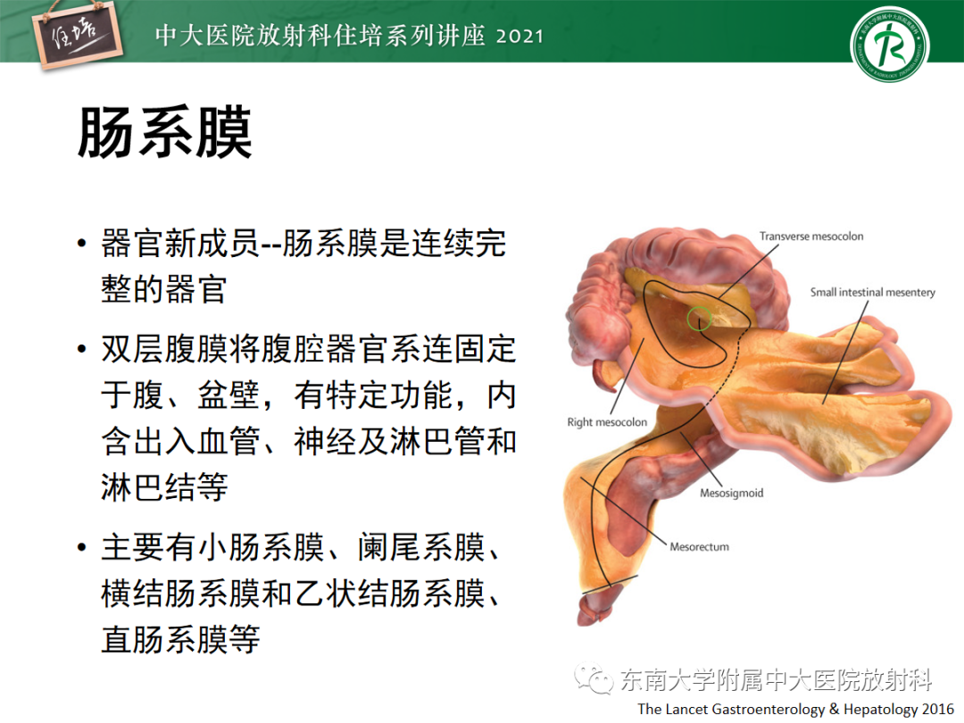 影像PPT - 【PPT】腹膜病变的影像分析思路-4
