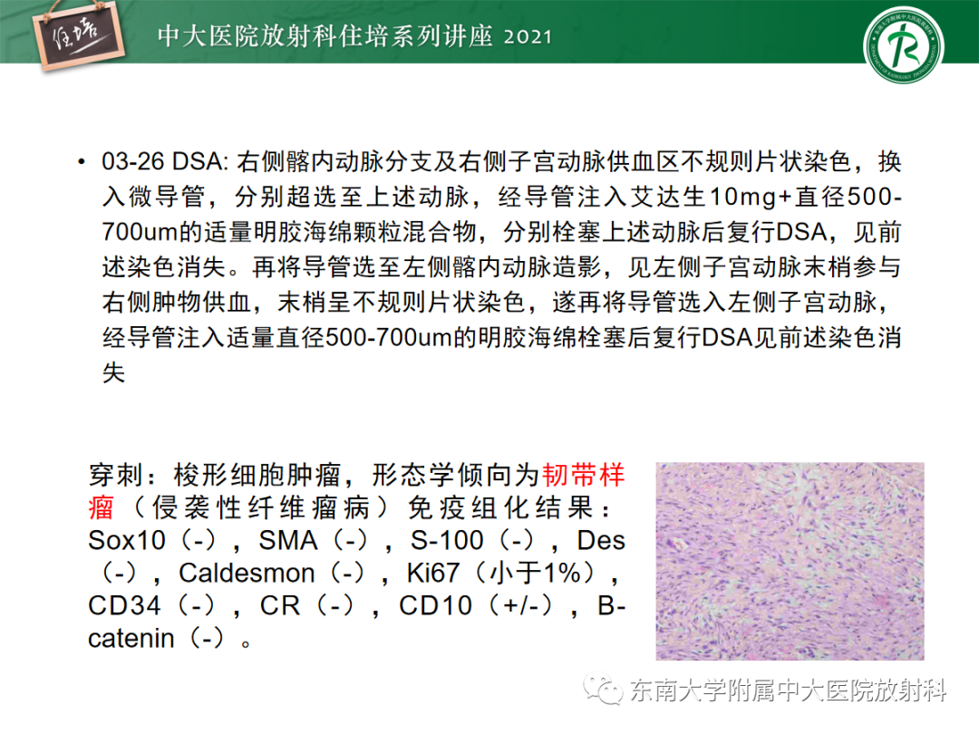 影像PPT - 【PPT】腹膜病变的影像分析思路-13