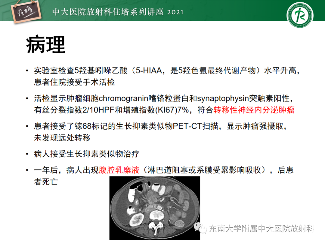 影像PPT - 【PPT】腹膜病变的影像分析思路-38