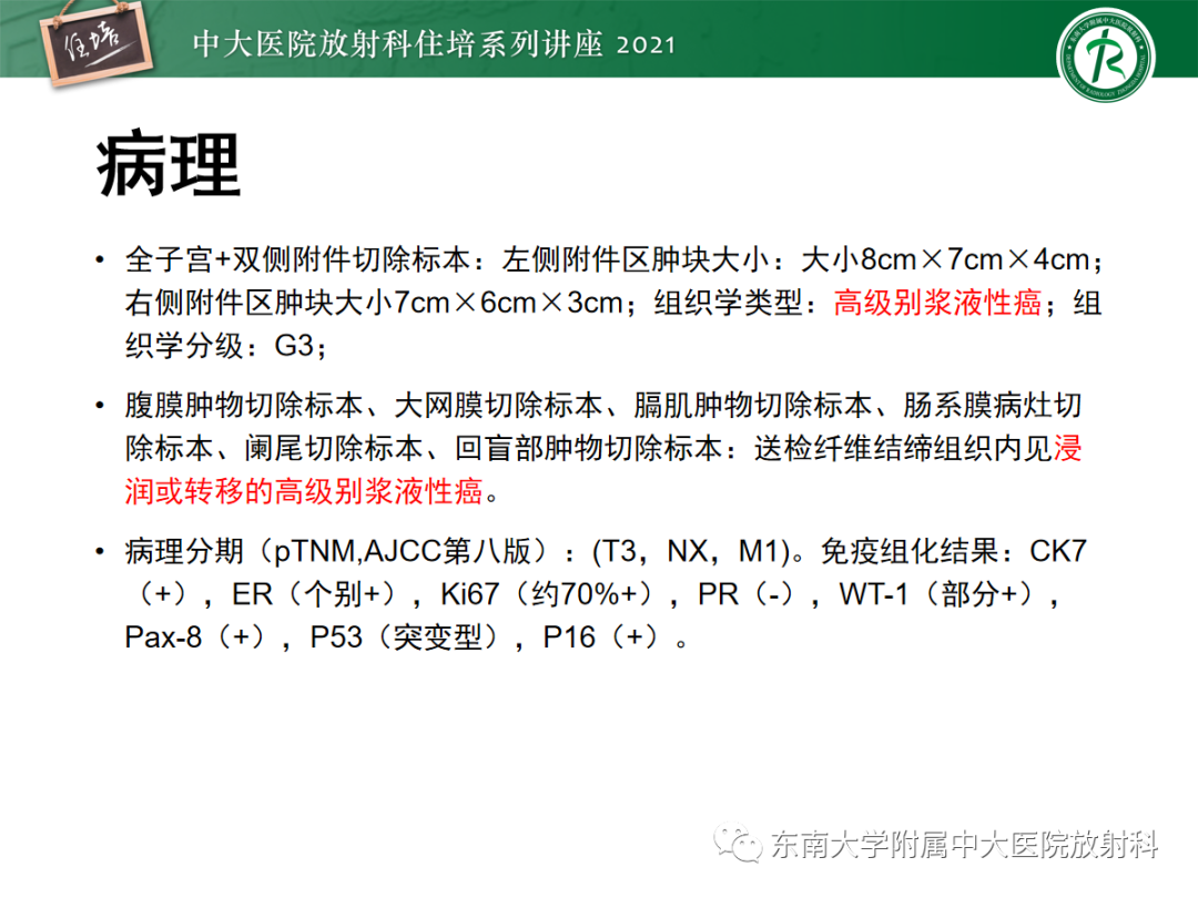 影像PPT - 【PPT】腹膜病变的影像分析思路-47